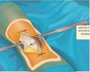 Virtual knee surgery ingyen játék